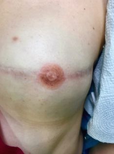 Uno de los tatuajes realizados por Jiménez a una mujer tras superar una enfermedad de cáncer.  // CharryTV