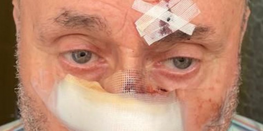 Imagen de uno de los ancianos agredidos por este delincuente, que salió de la cárcel hace varios meses tras cumplir condena por asesinato