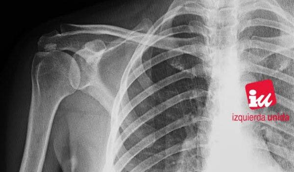 El edil de la coalición de izquierdas ha realizado una radiografía de su vida económica.