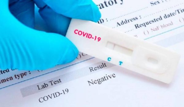 Los asociados interesados en hacerse el test deberán contactar con Apymer para obtener cita.