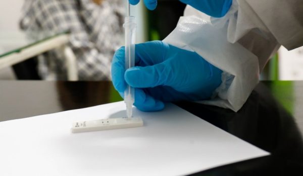 Los cuatro positivos en COVID-19 corresponden a vecinos de Ronda.