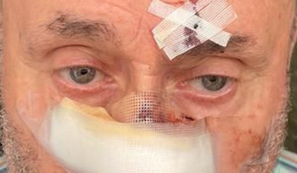 La Policía Nacional investiga el caso con el objetivo de proceder a la detención del autor de los hechos