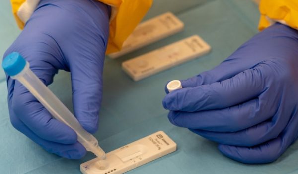 Según el informe que publica la Consejería de Salud, en las últimas 24 horas se ha diagnosticado el virus a 65 vecinos, mientras que otros 76 se han recuperado.