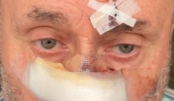 Imagen de uno de los ancianos agredidos por este delincuente, que salió de la cárcel hace varios meses tras cumplir condena por asesinato